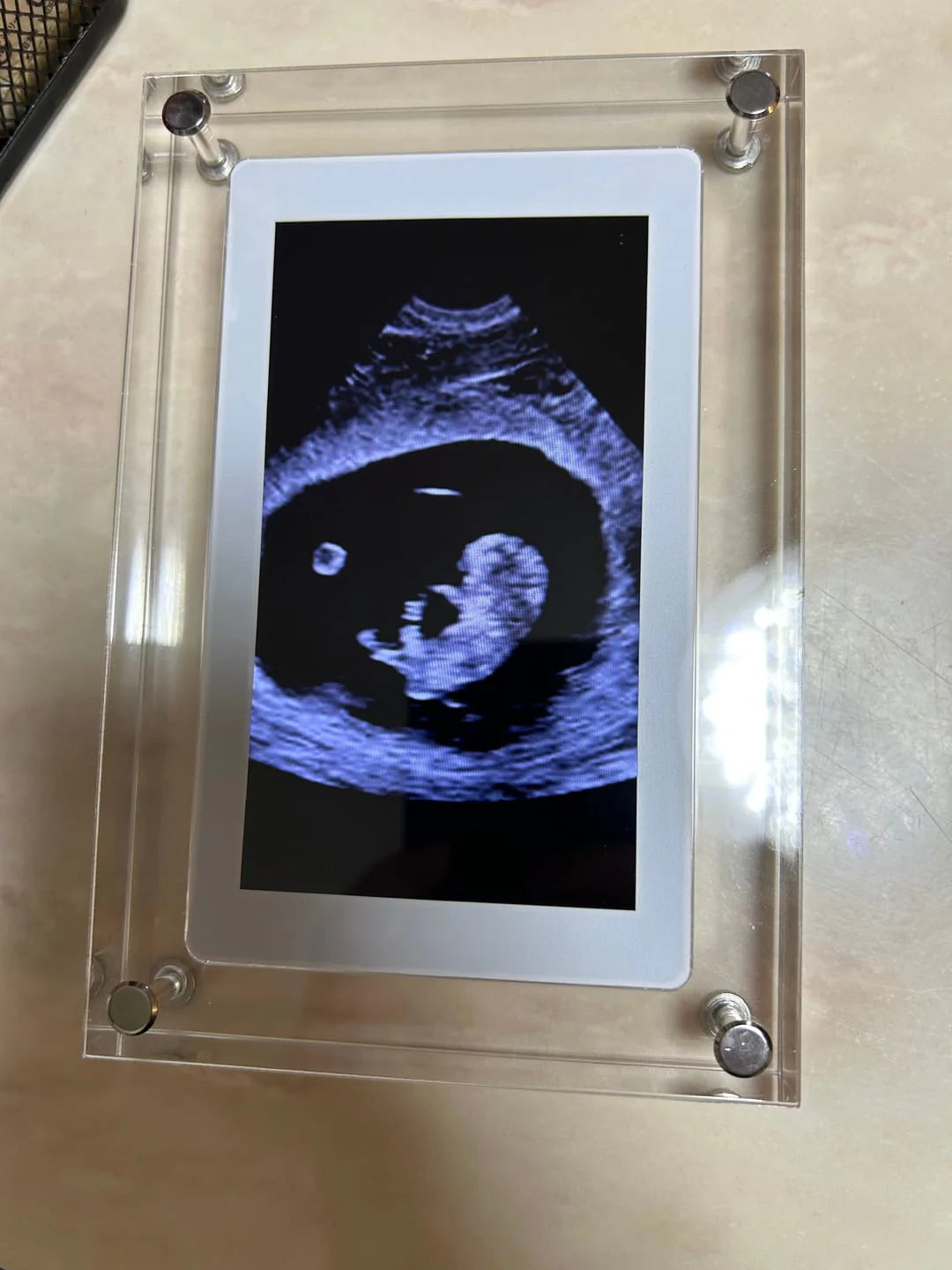 LucidView™ Digital Frame