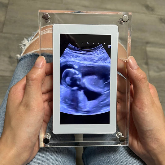 LucidView™ Digital Frame