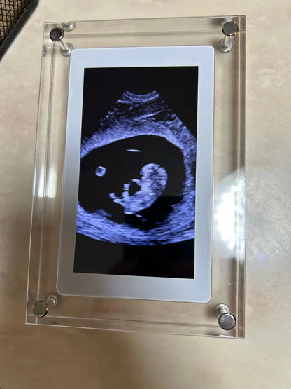 LucidView™ Digital Frame